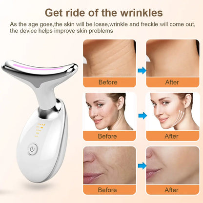 Neck Face Lifting Beauty Device